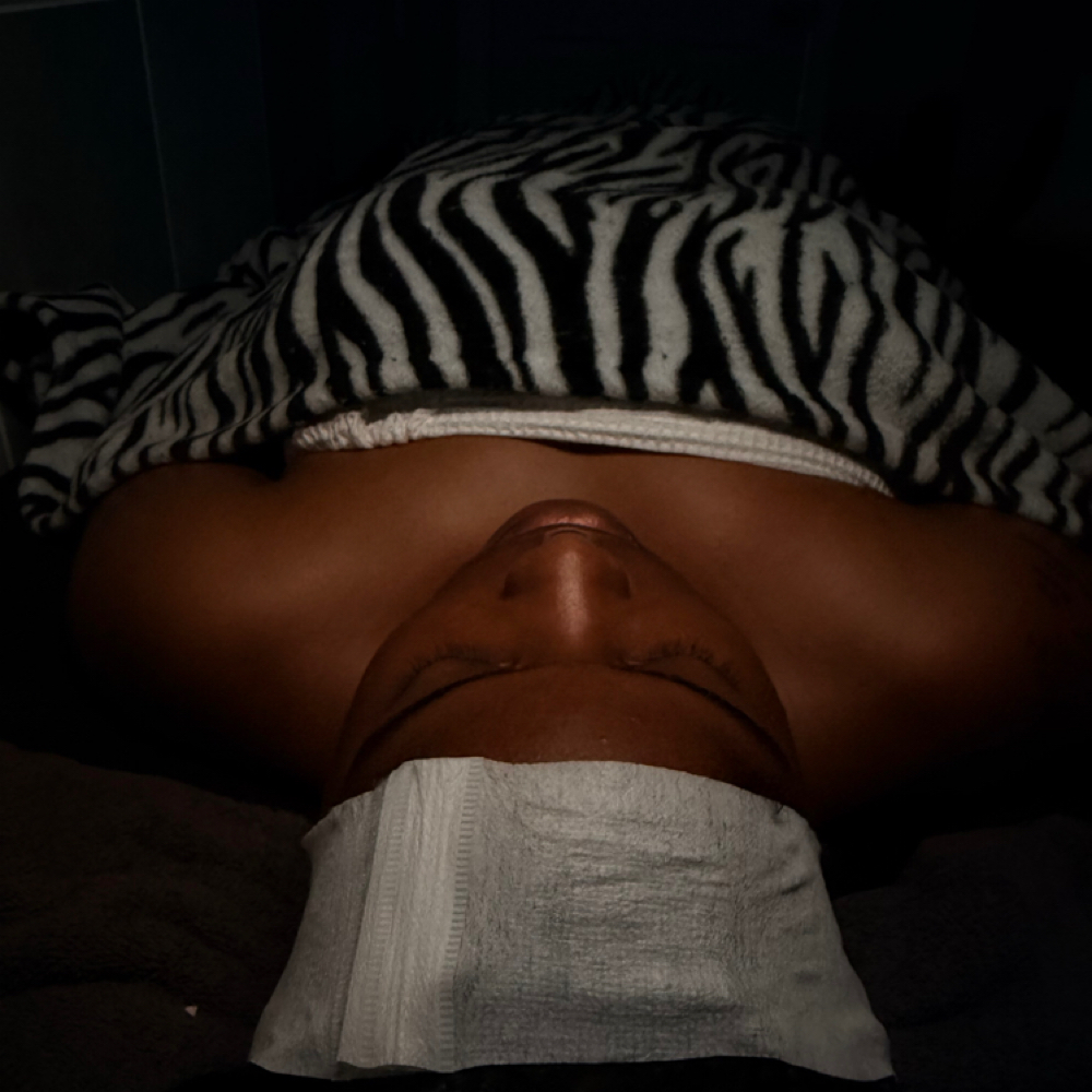 Teen Acne Facial at Glammed By Le Aesthetics in Ullin, IL