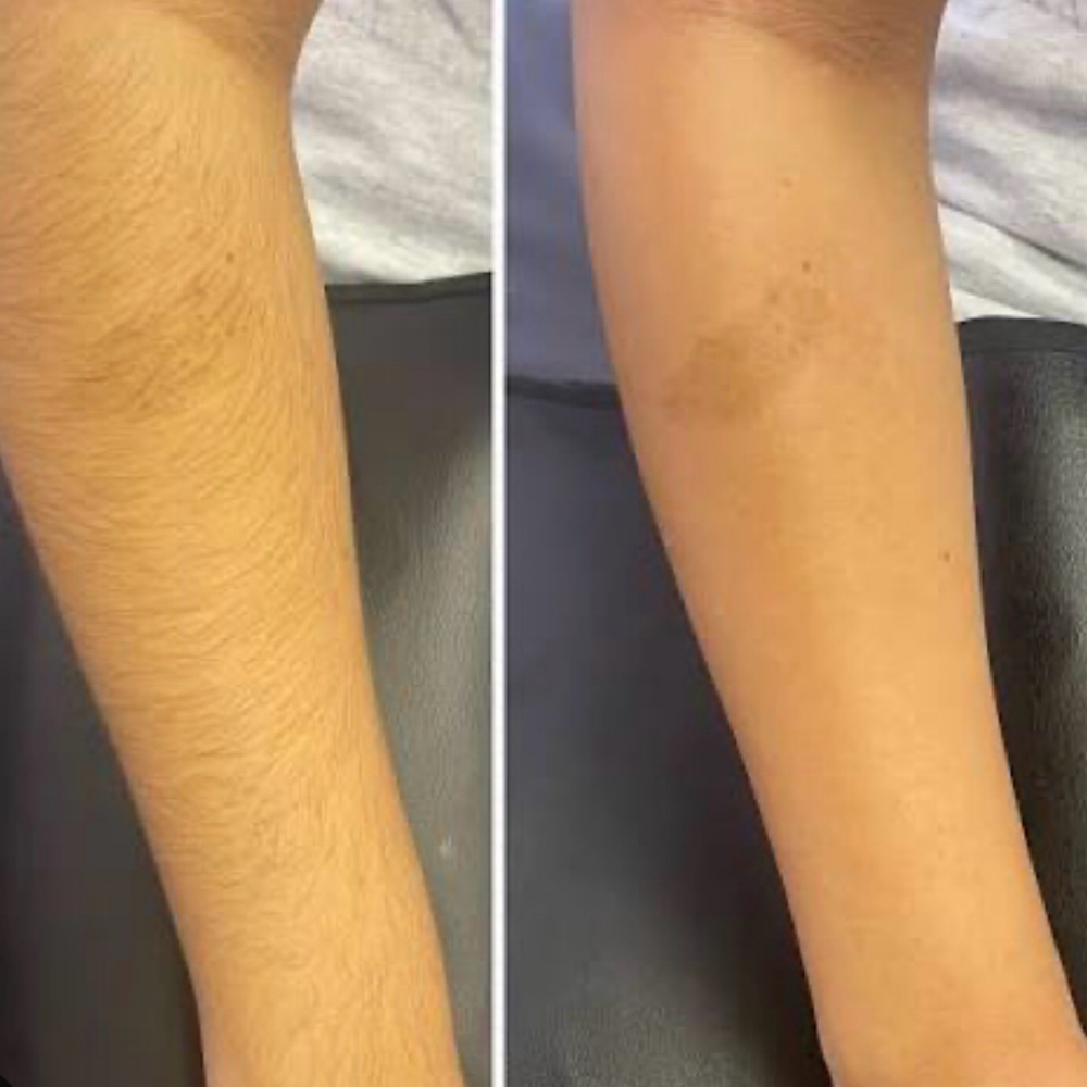 Half Arm Wax at Four Roots Beauty Collective in rock island, IL