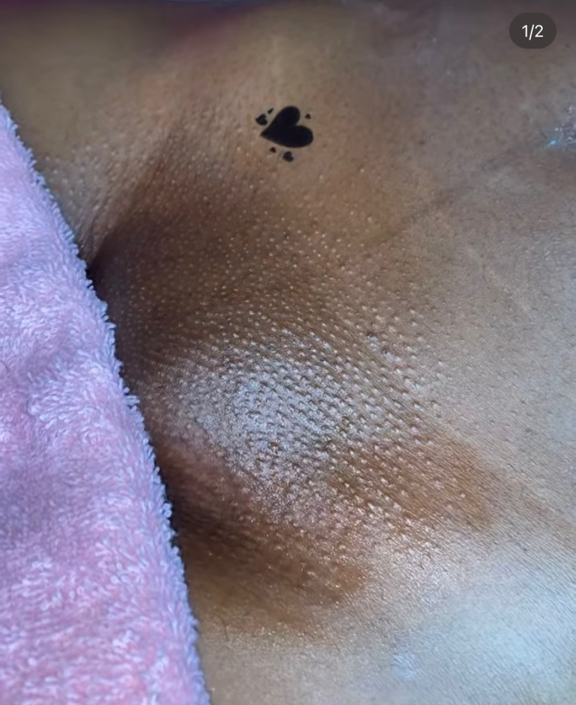 Brazilian Wax