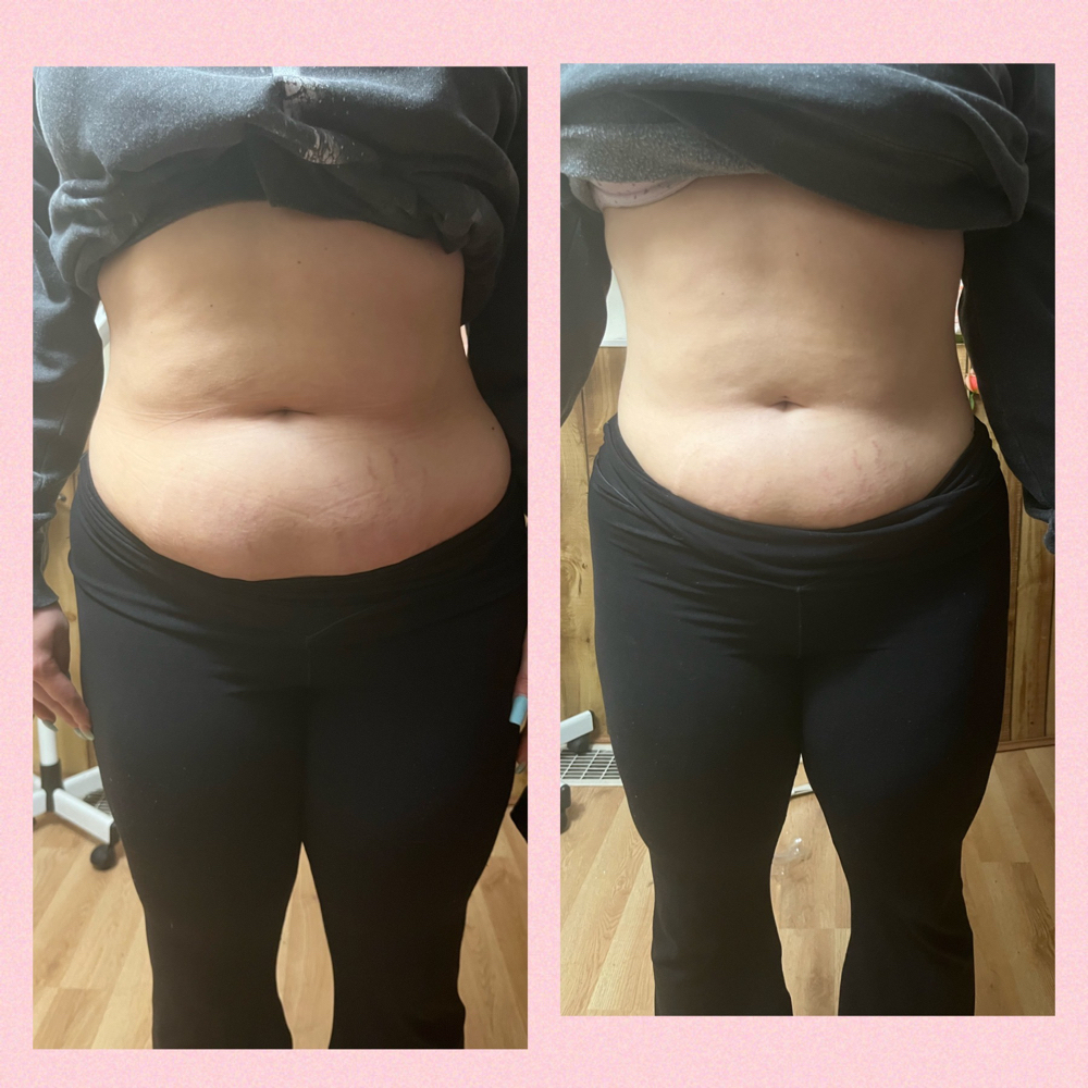 Tummy Tighten at Alexis Kirby in Dayton, OH