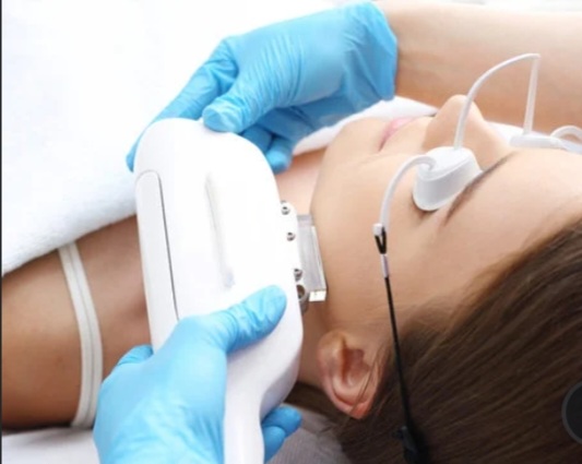 IPL FOTO Facial