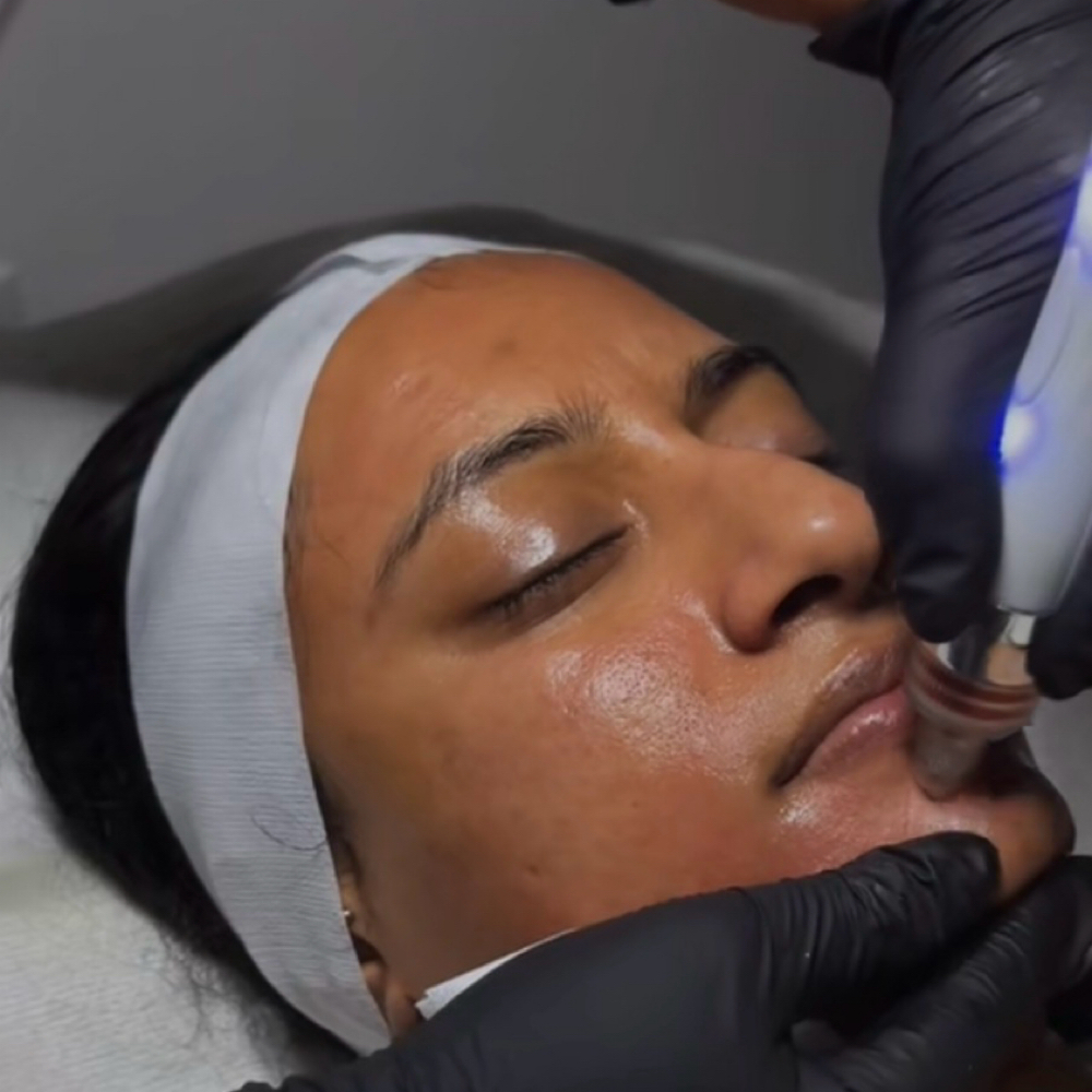 HydraFacial at Untamed Radiance in Lanham, MD