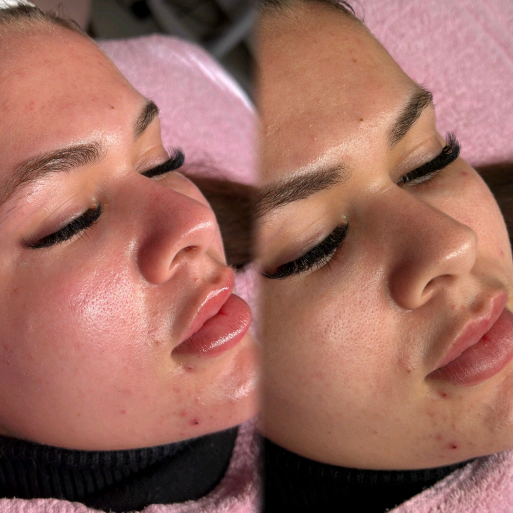 Glam Signature Detox Facial at Glam by Maiotti in Hartford, CT