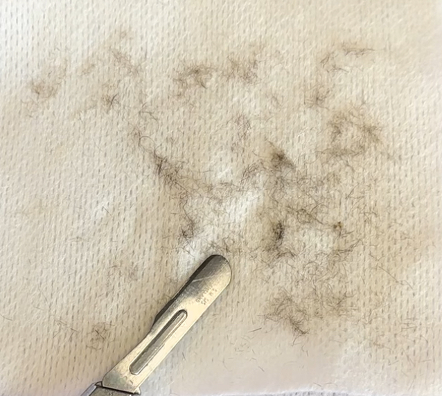 Dermaplaning Facial