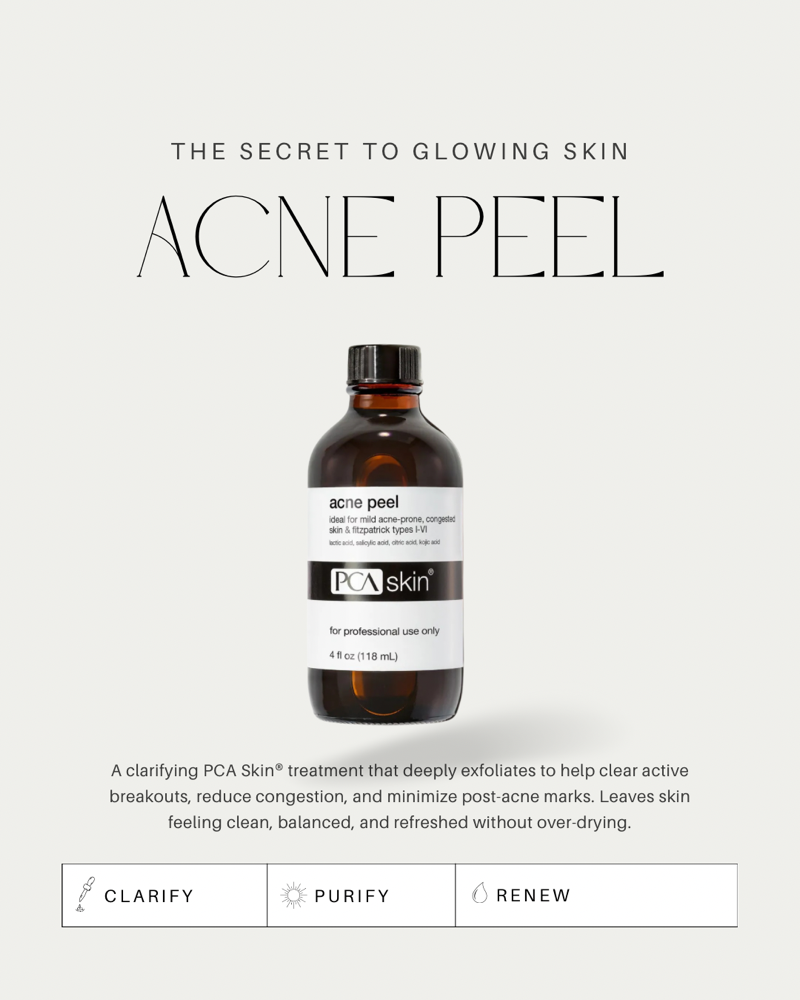 Acne Peel