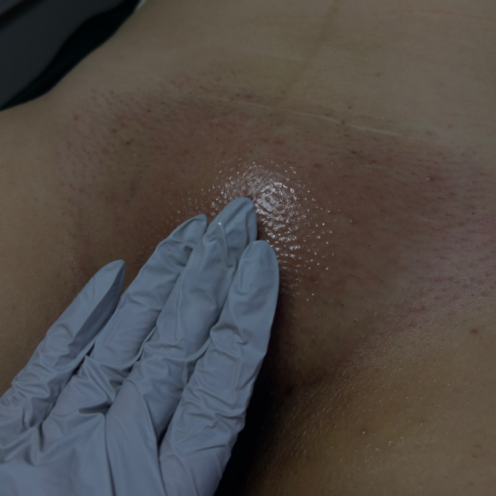 Brazilian Wax at Baire Skin Spa in Visalia, CA