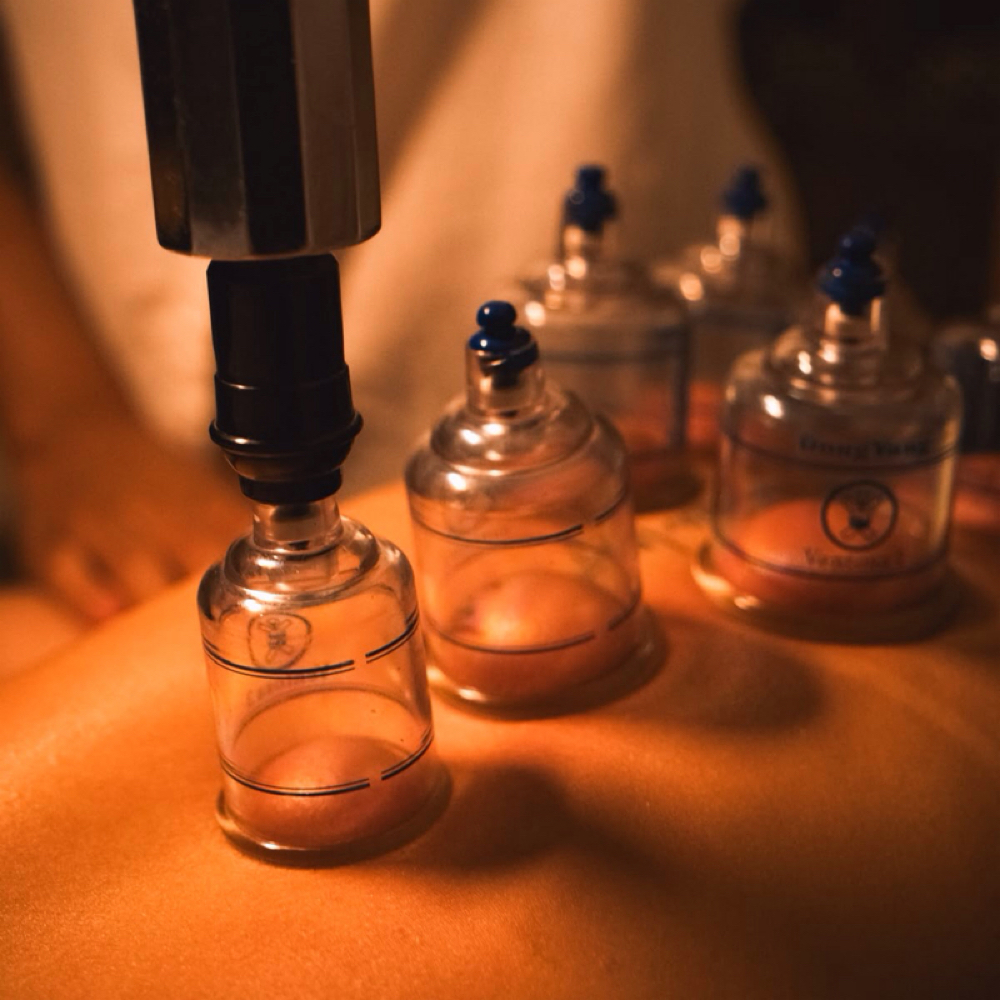 ADD ON + dry cupping therapy at Raymar Wellness LLC in Willmar, MN