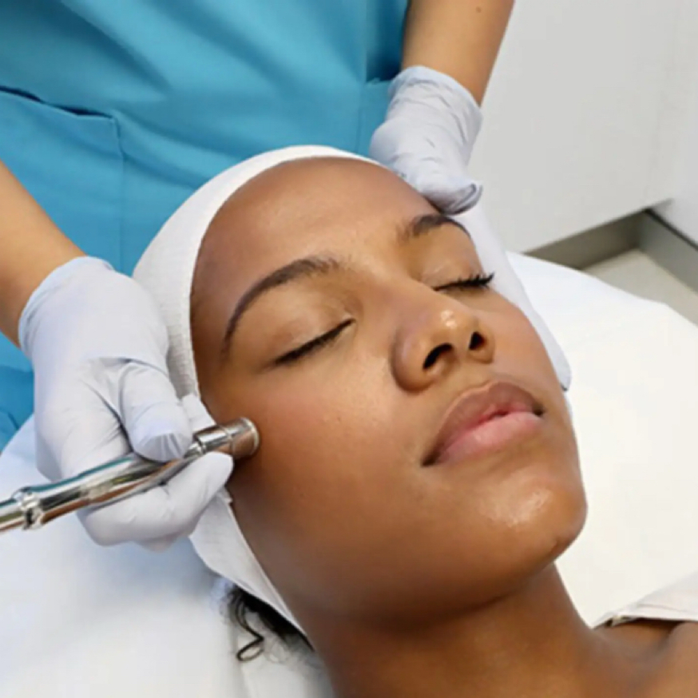30 Minute Microdermabrasion at B. Rucker Beauty Co. in Hendersonville, TN