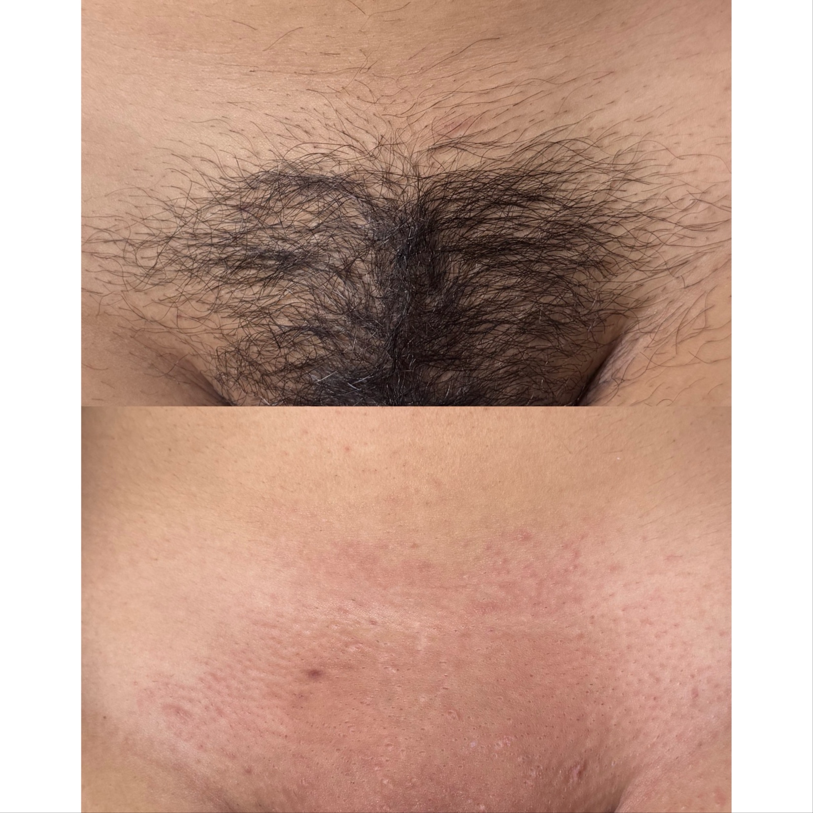 Brazilian at Starlight Wax Studio in San Antonio, TX