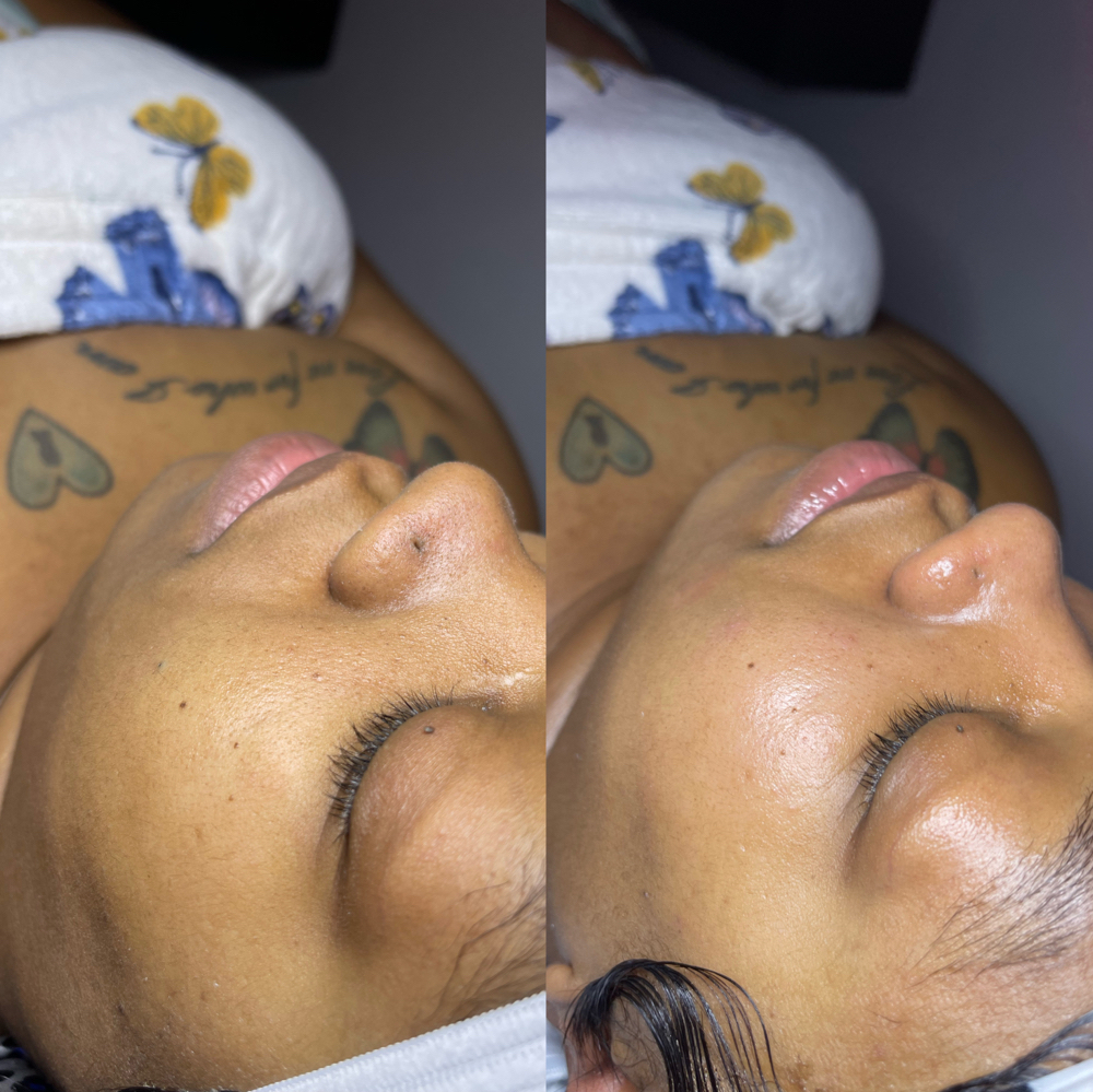 Silken DeepCleanse Facial