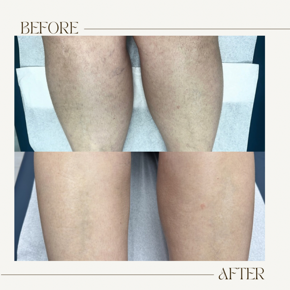 Half leg wax at Lash&Glo in Boerne, TX
