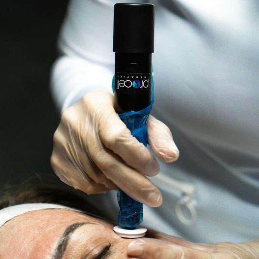 Microchanneling x Procell Therapies