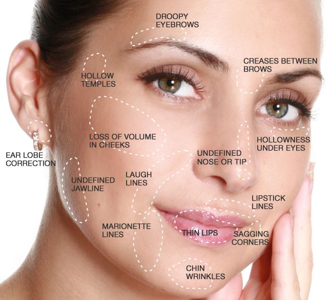 Cosmetic Fillers