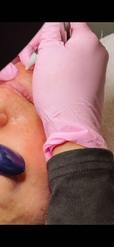 Electrolysis 15 min at Brilliant Effect in Columbus, GA