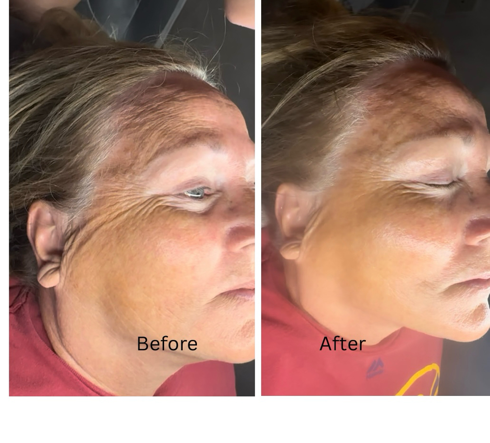 Facial - Ageless Beauty