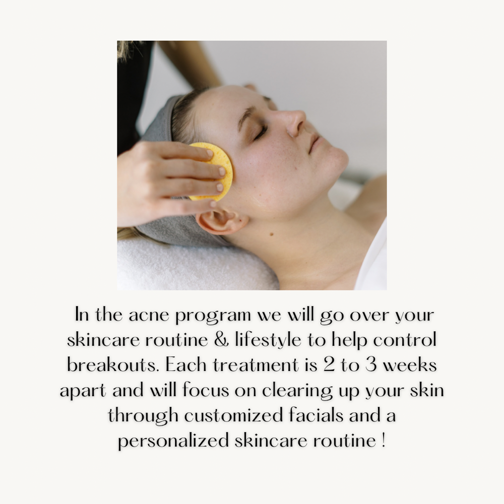 Acne Program Initial Consult+Facial