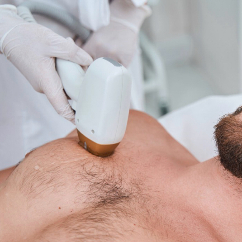 Chest Hair Laser Single Session at Blessed & Bare Laser Studio in New York, NY