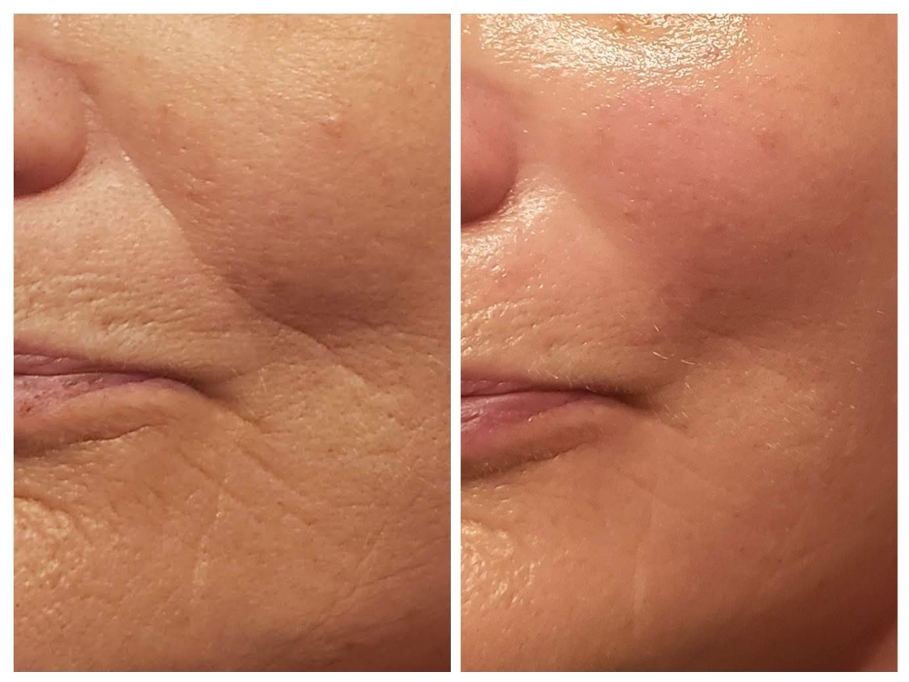 Red Carpet Anti-aging Facial
