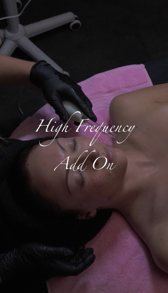 High Frequency ADD ON