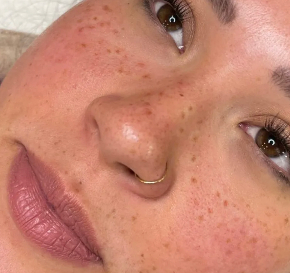 Semi Permanent Frckles