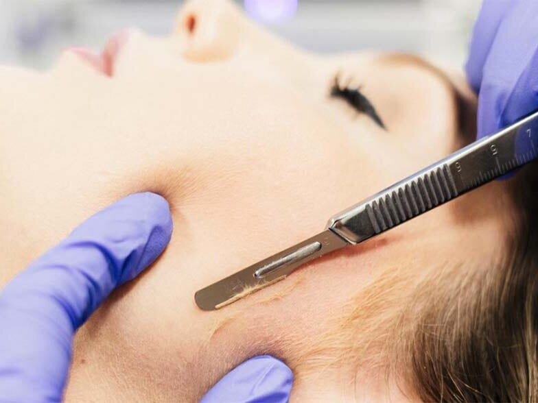 Dermaplaning & Sensi-Peel Facial