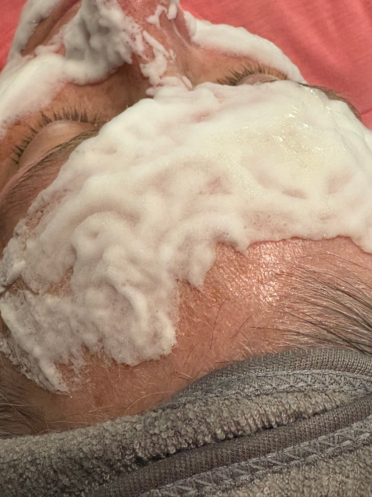 Oxygen Lift Treatment
