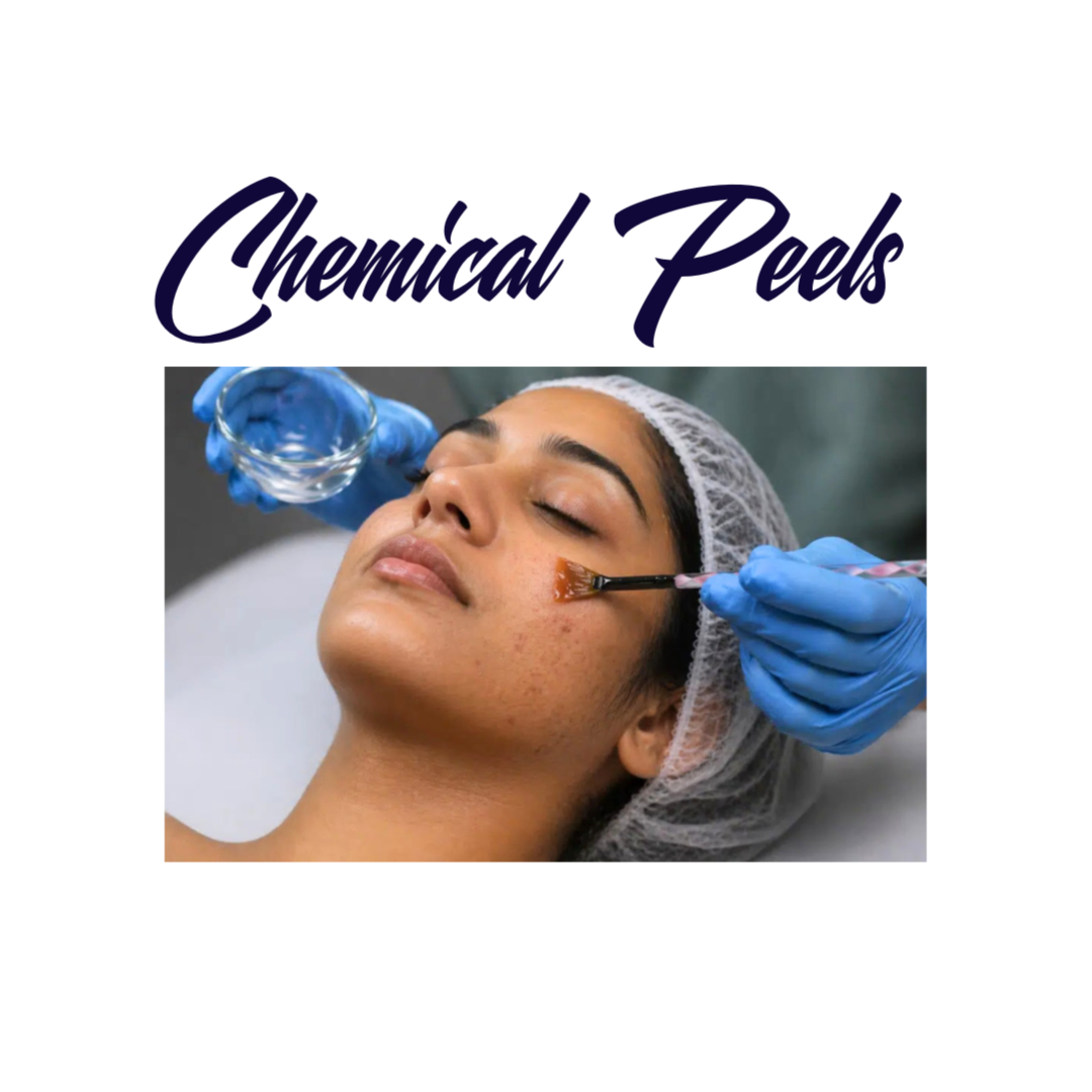 Chemical Peels at Royal Esthetics & Wellness in Oro Valley, AZ