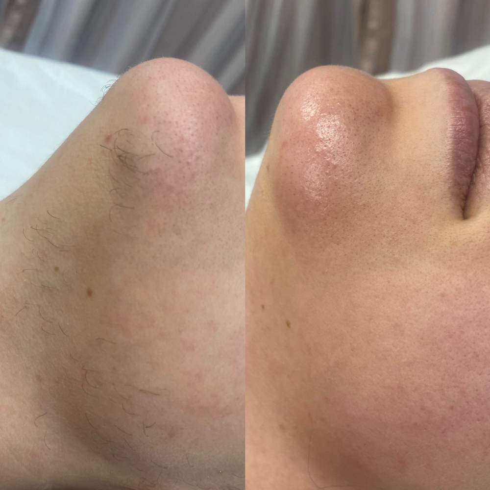 Chin at Blooming Beauties Co. in Huntsville, AL
