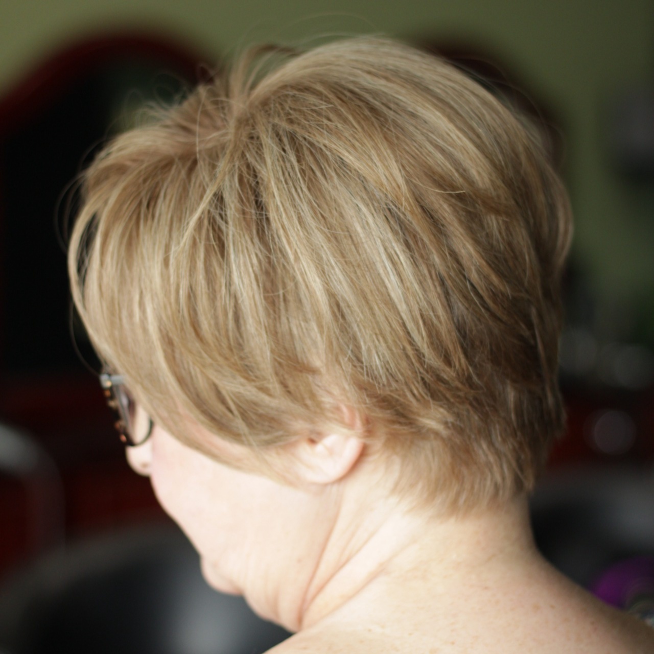 New Guest Hairloss Solution Consult