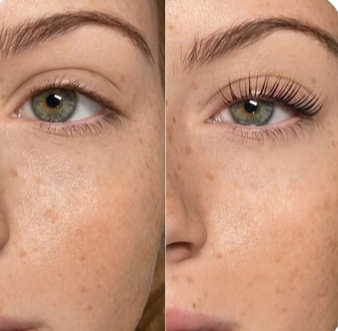 Lash Lift