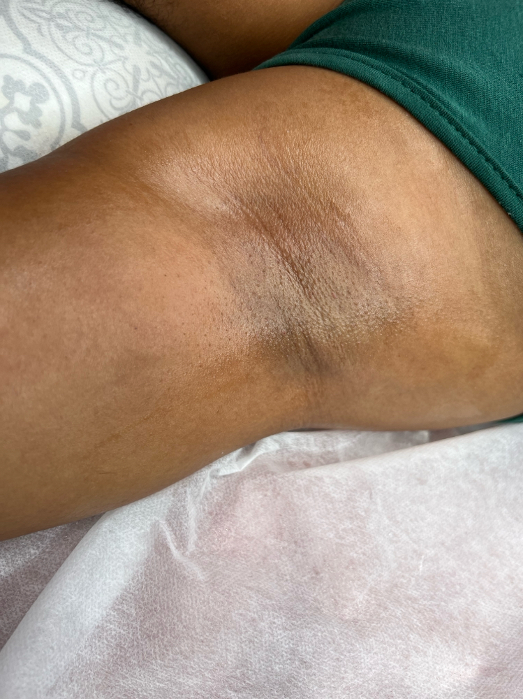 Underarm Wax at Adarable Esthetics LLC in Taunton, MA