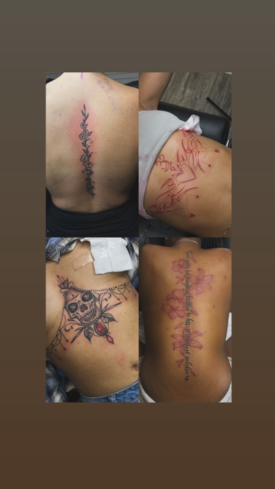 ALL OTHER (spines, Sternum, Etc)
