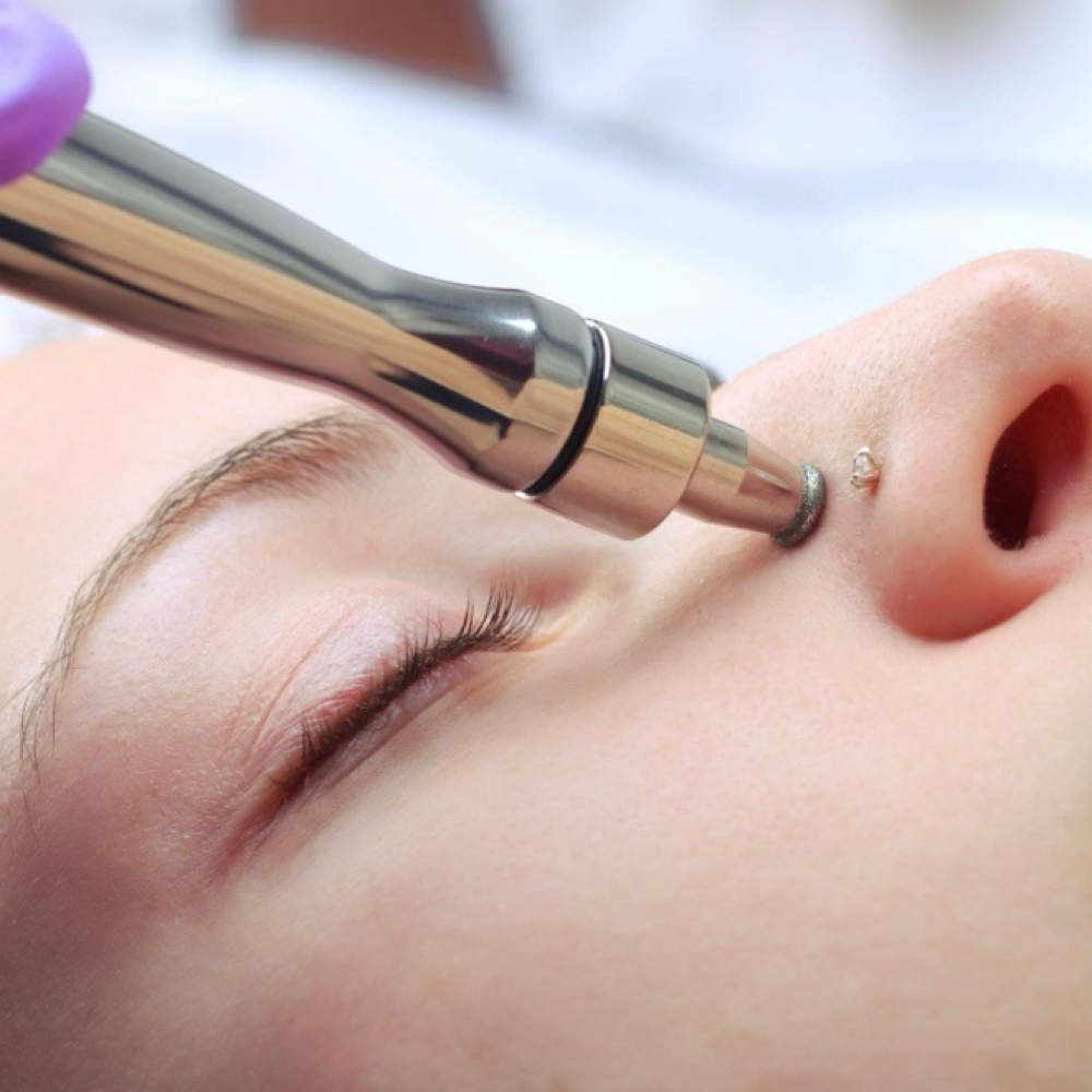 Add On  (Microdermabrasion) at Elveera Esthetics in Madison, AL