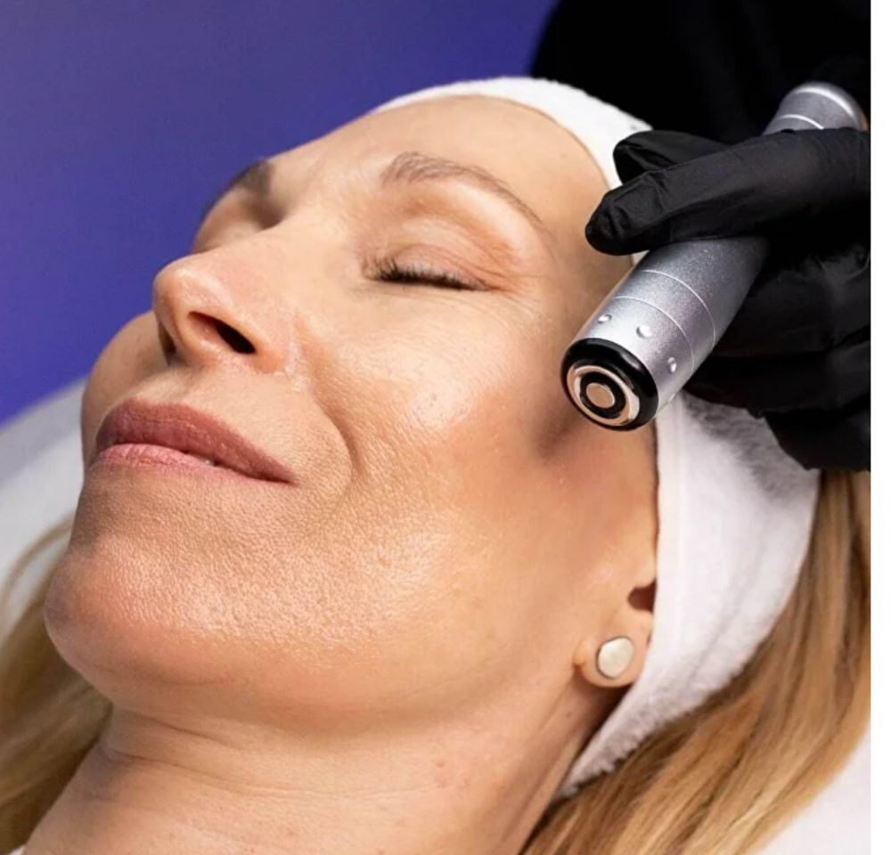 Radiant RF Lift (Zemits FrioLift)