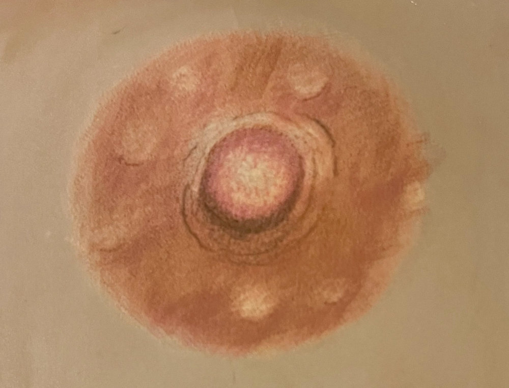 Areola Pigmentation