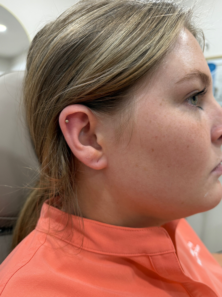 Ear Piercing - Helix