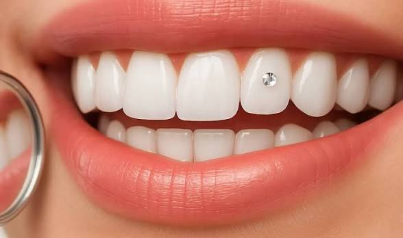 Swarovski Tooth Gem at Grin & Glow in Artesia, CA