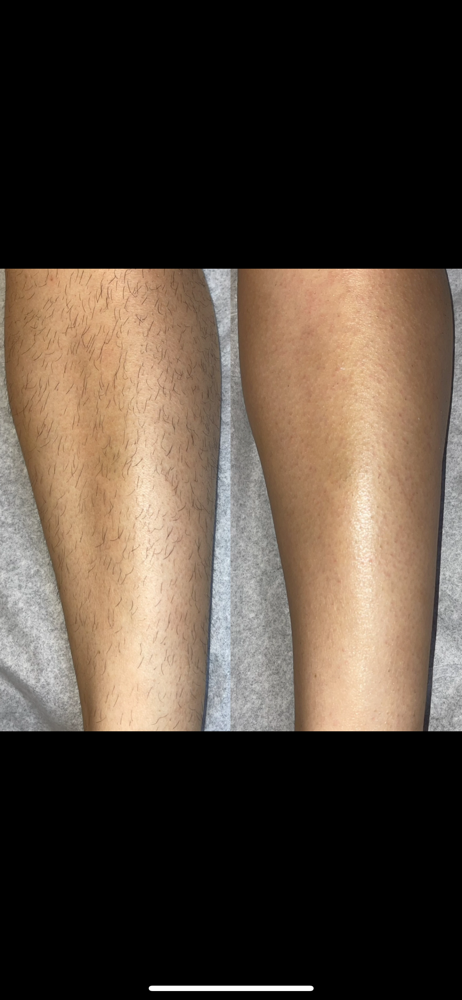 Lower Leg Wax