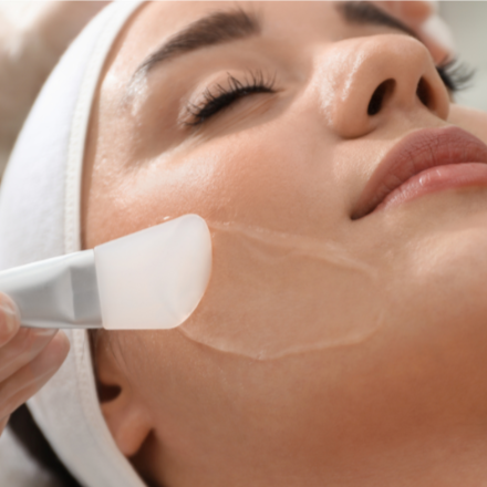 The Perfect Derma Peel at DM Laser Skin Care Solutions in Needham, MA