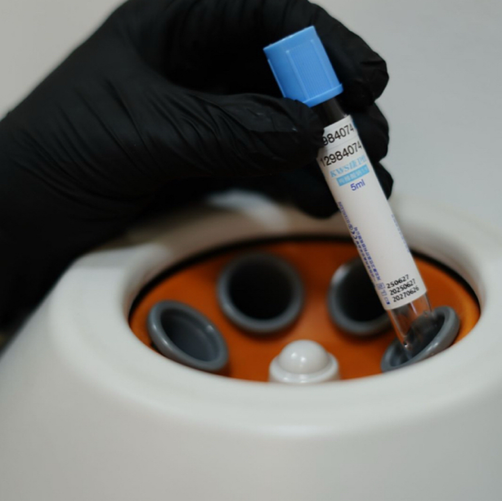 PRP (Plasma Rico Plaquetas) at 180º Med Spa in Dallas, TX
