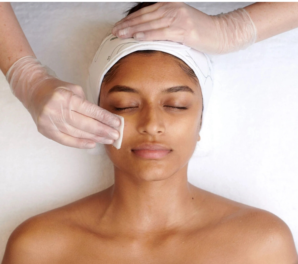 Chemical peel Treatment