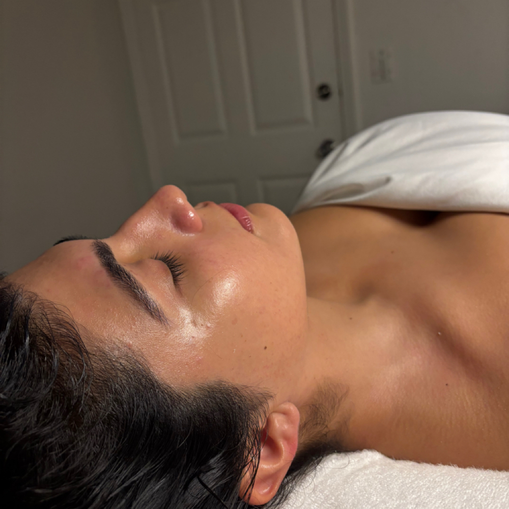 Microdermabrasion Facial at Esthetic Bar Retreat in Canoga Park, CA