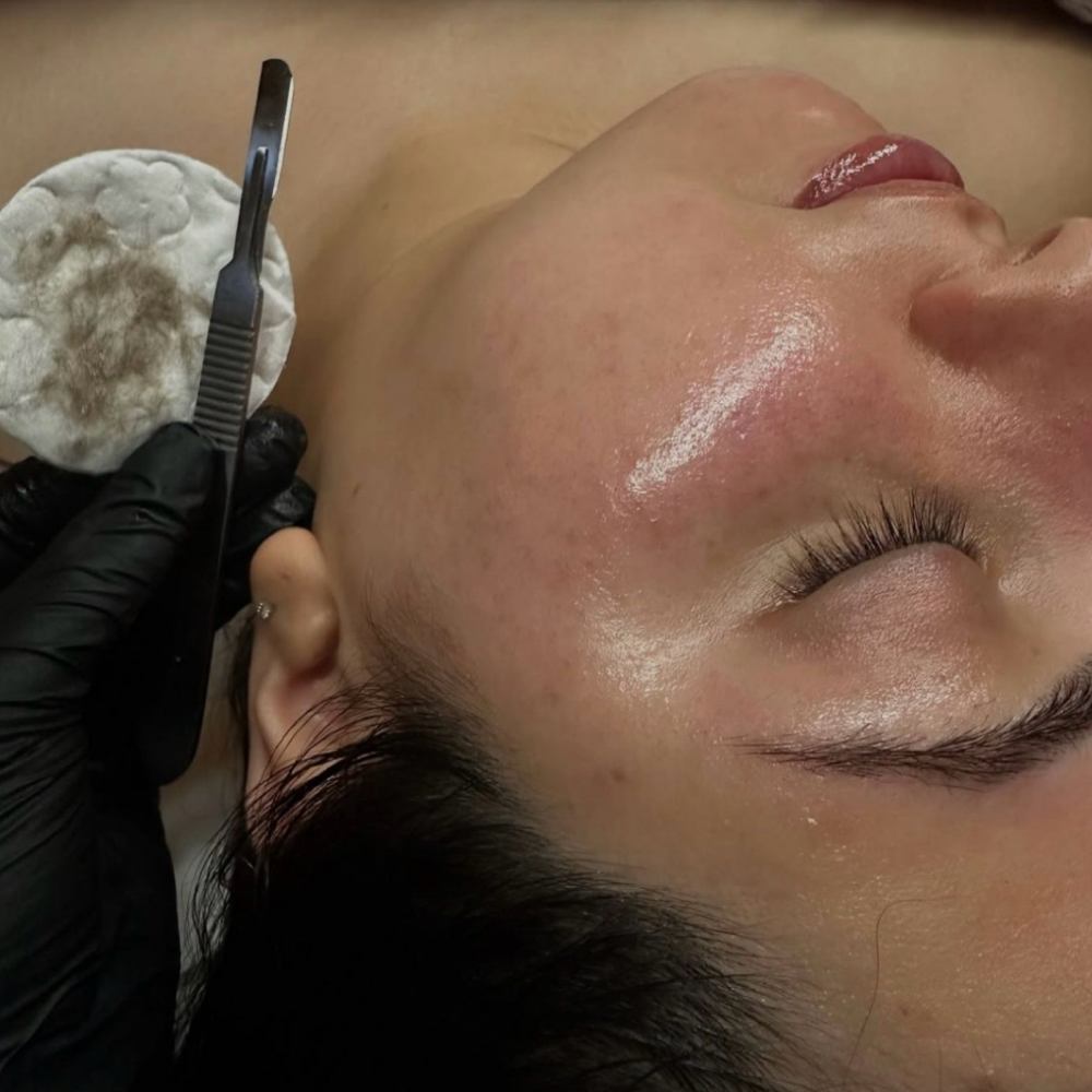Peachy Keen | Dermaplane Facial