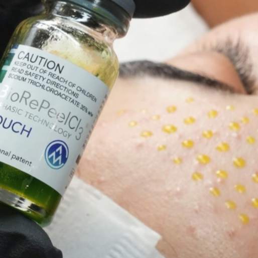 Biorepeel Single Session at BLUSH Aesthetics LLC in Laredo, TX