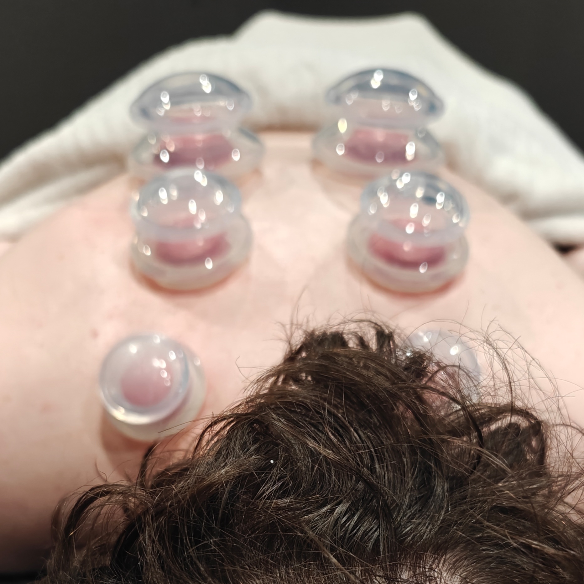 ADD-ON: Cupping at VANSTONE in Jonesboro, AR