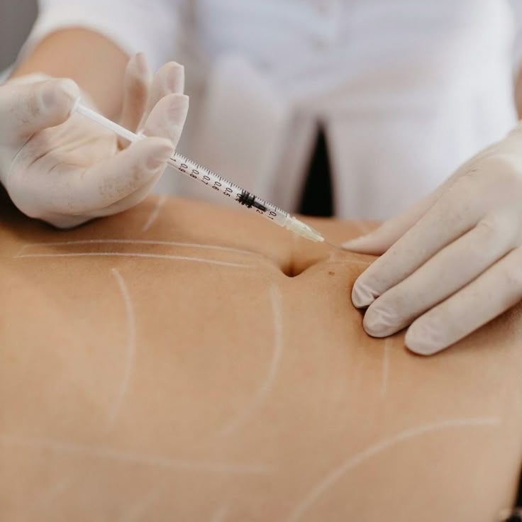 LYPOENZYME at Remake Beauty Studio San Juan in San Juan, TX