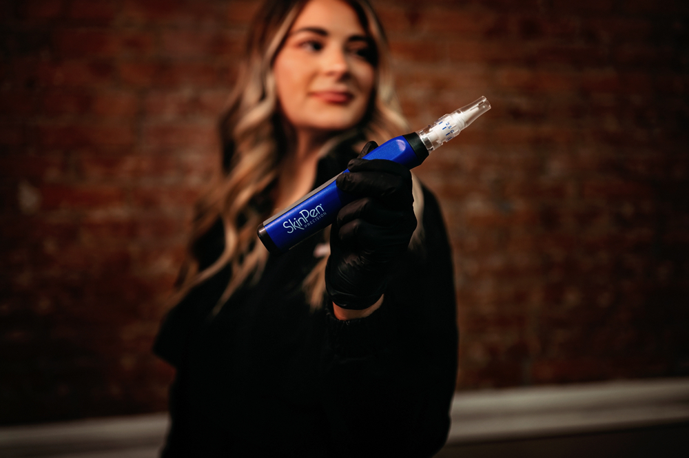 Skinpen Microneedling