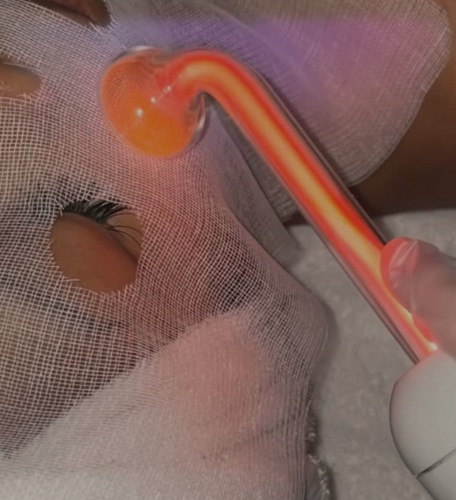 Add On: High Frequency