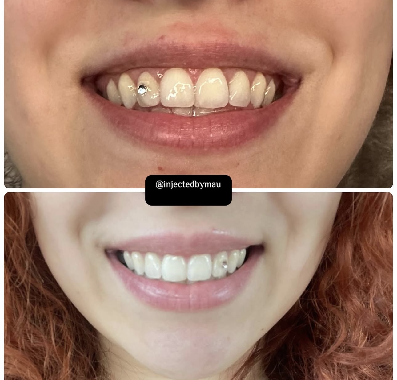 Lip Flip at The Needle Studio Tx in Cleburne, TX