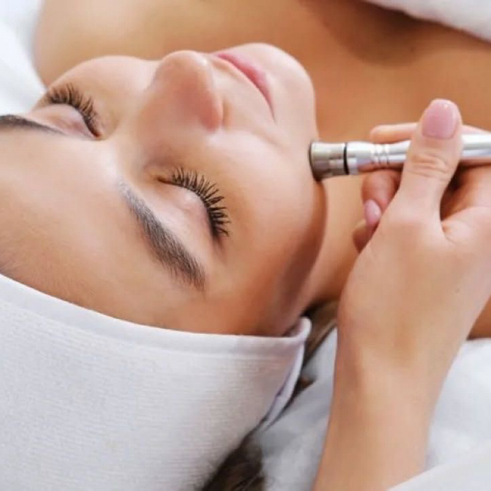 Diamond Microdermabrasion at Nirvana Skincare & Aesthetics in Missouri City, TX